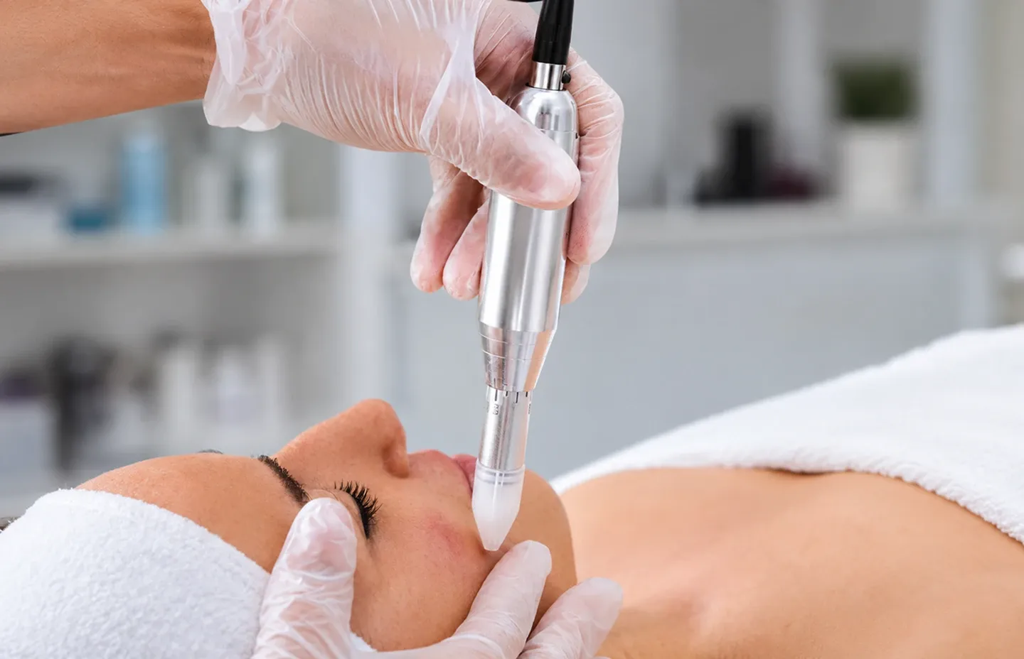 Microneedling Nanopore
